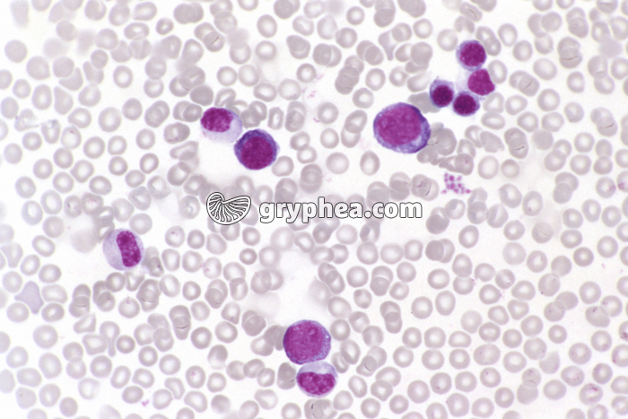 Moelle osseuse x200 - gryphea.org